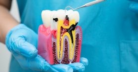 root canal abu dhabi
