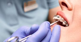 Orthodontic-Treatments